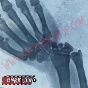 Vinilo LP Negativo - Negativo